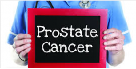 IS PSA THE TEST TO KNOW IF YOU HAVE PROSTATE CANCER?