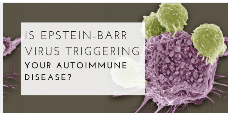 Epstein barr virus and autoimmunity connection