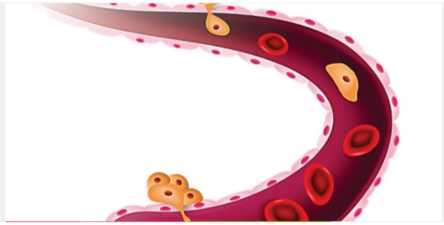 Screening cancer with liquid biopsy